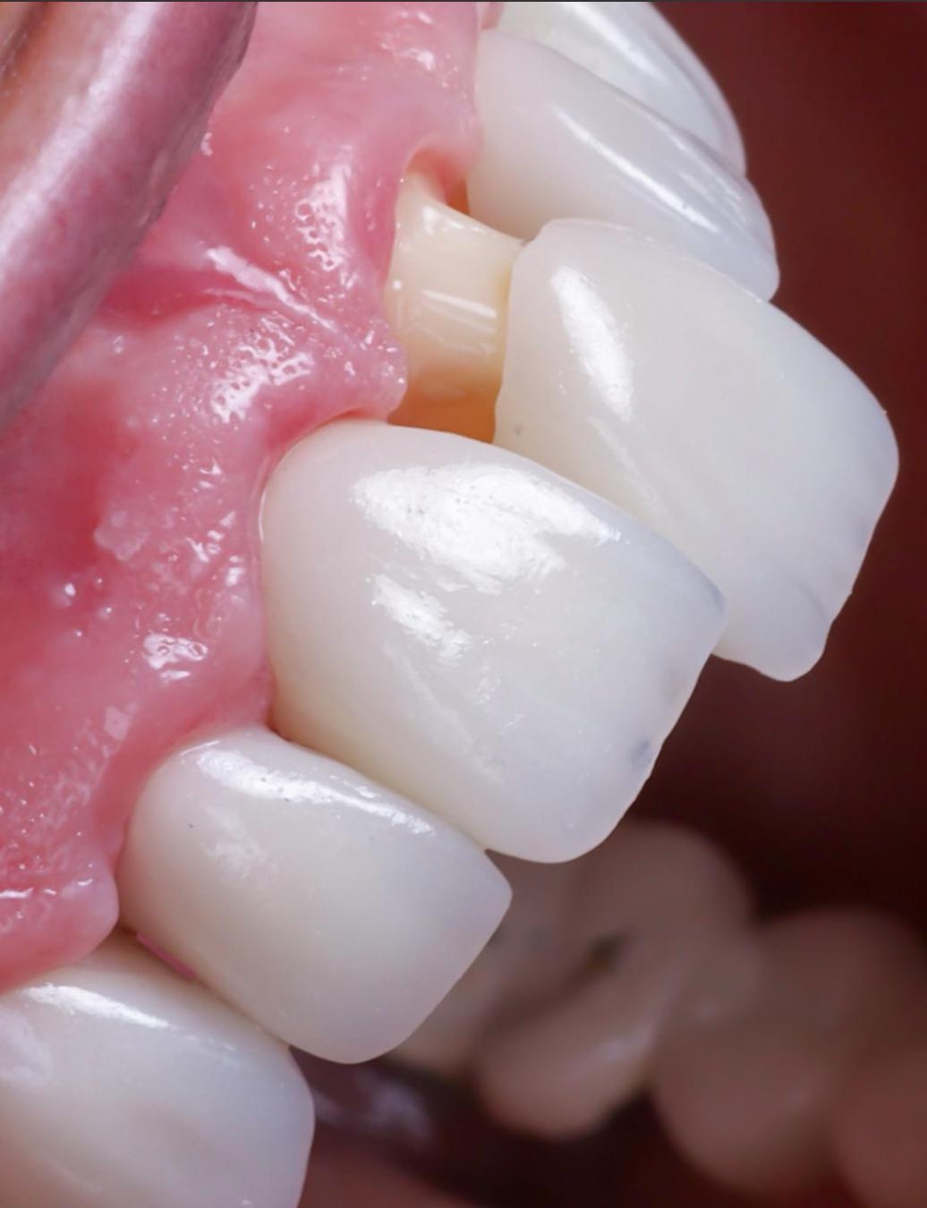 Detalle dental